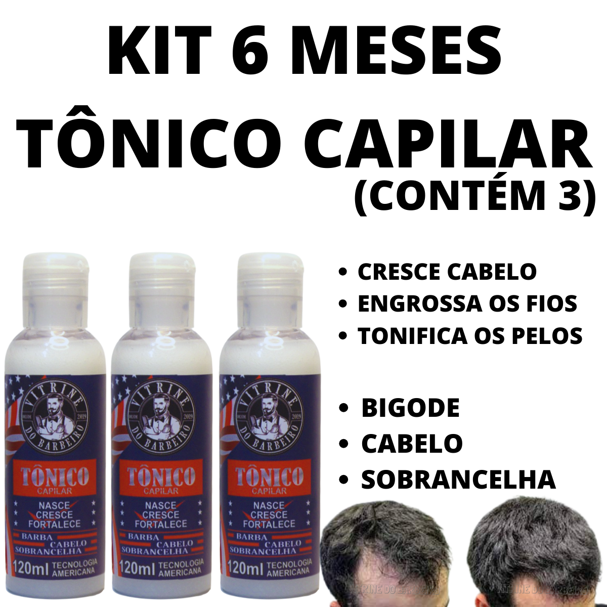 Kit 3 Turbo Tônico Crescimento Capilar Rápido Cabelo E Barba