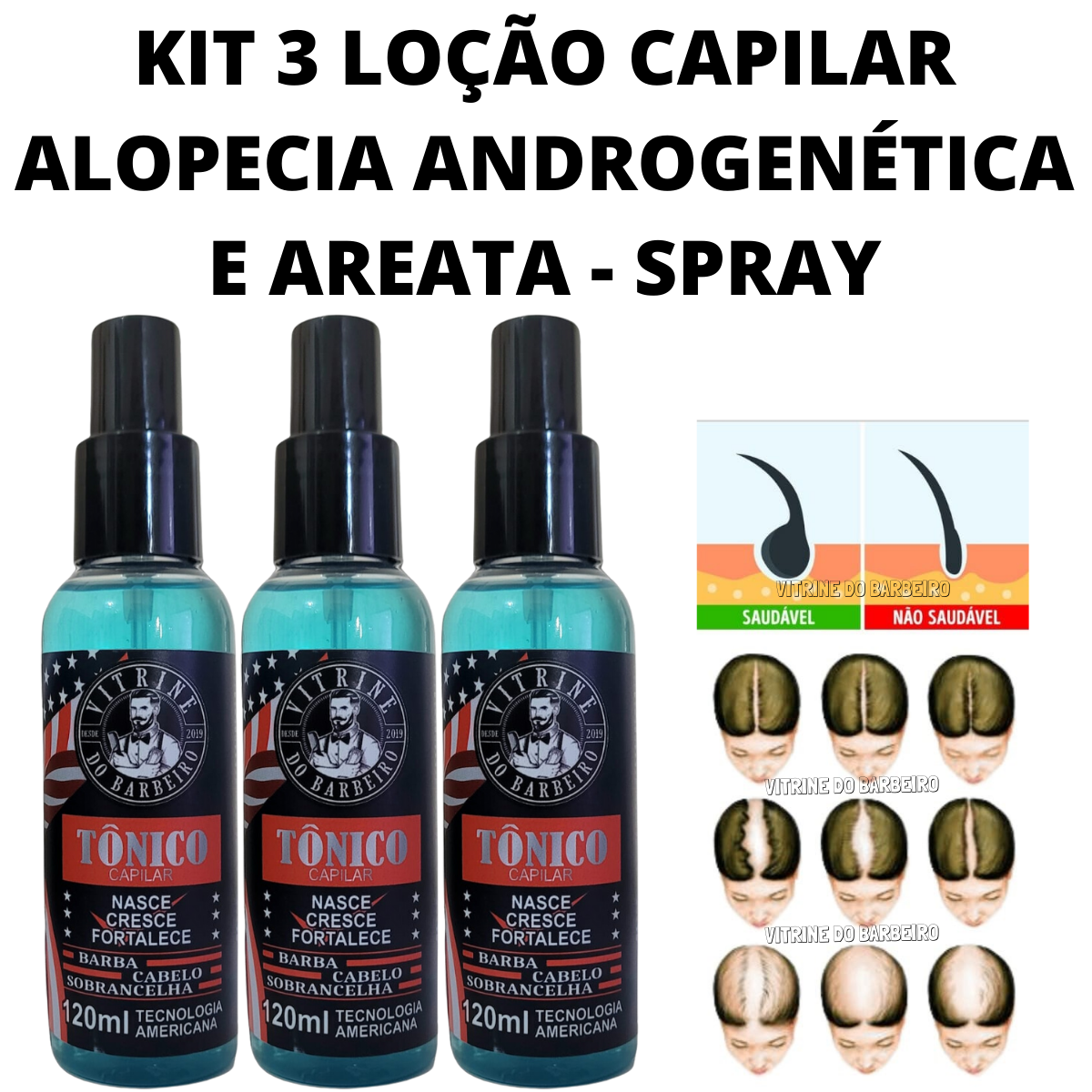 3 Tônico 120ml Nasce Cresce E Fortalece Anti Alopecia Areata