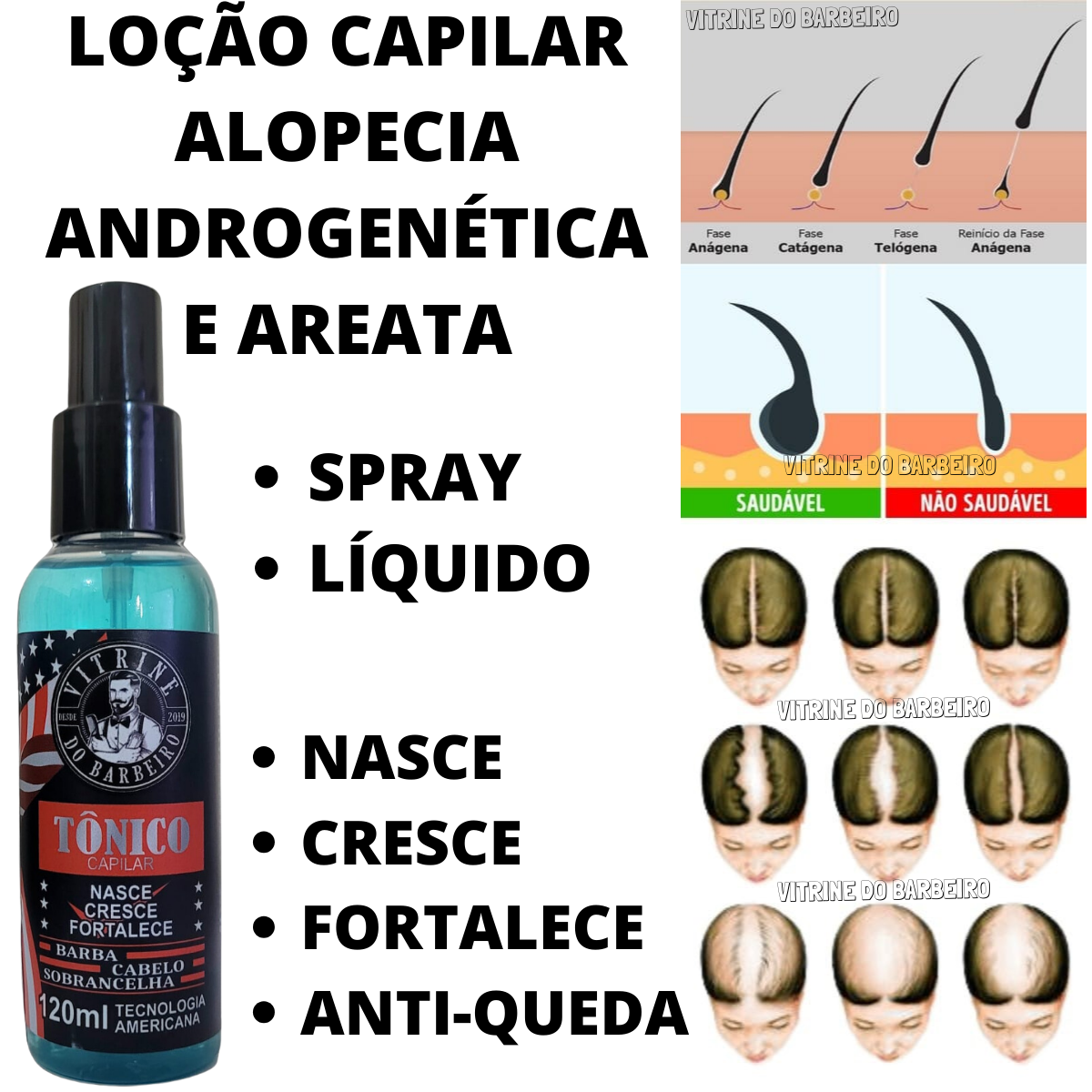 Tratamento Capilar Para Calvície Tônico + Rolo Microperfuração