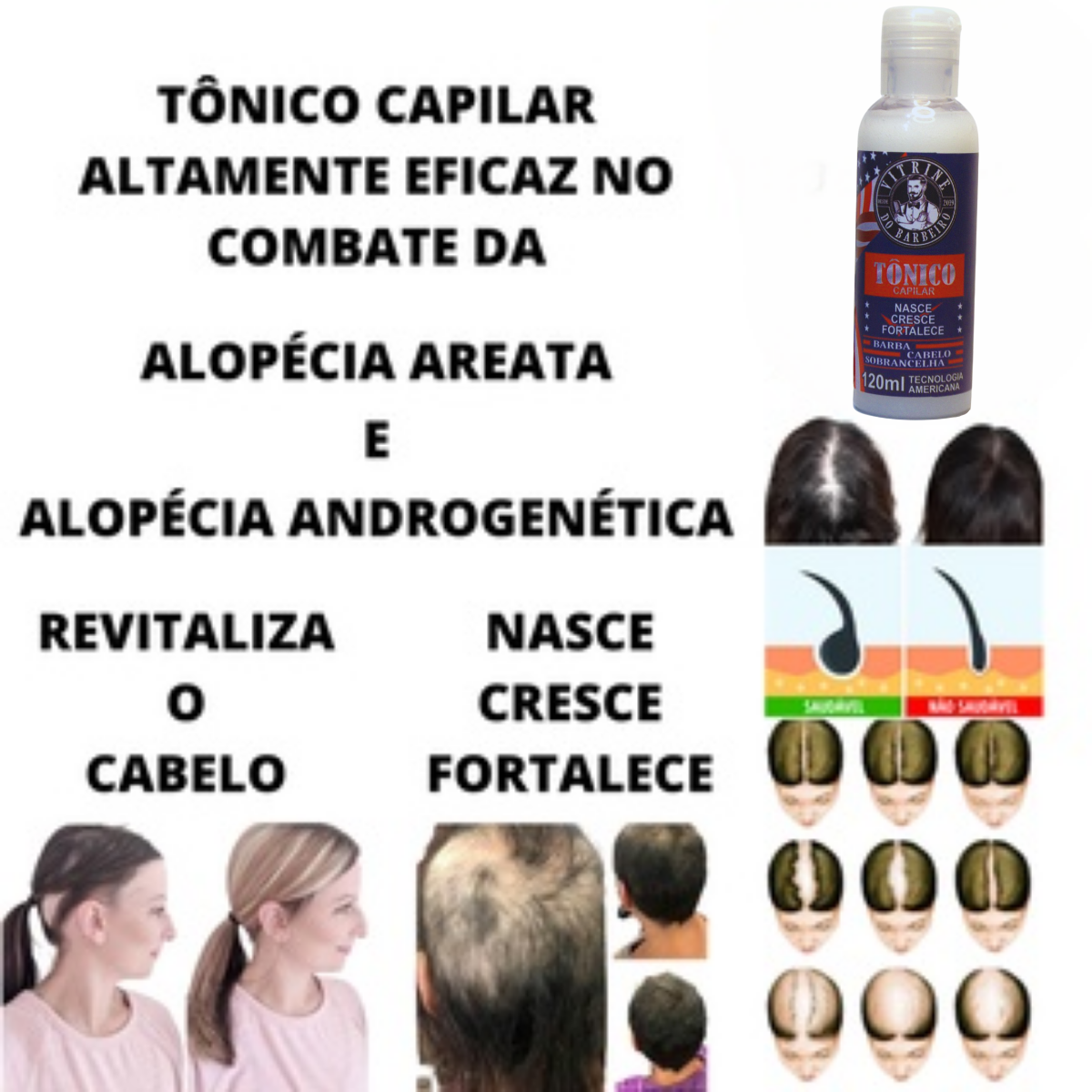 Tônico Nasce Cresce Cabelo Para Calvície Antiqueda